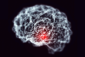 neuroinflammation
